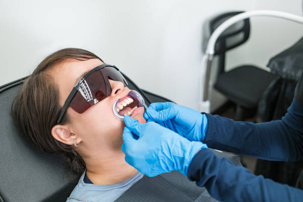 Best Emergency Wisdom Tooth Extraction in Reedspt, OR